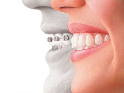 The image features a split-screen graphic with two different perspectives on the left, an adult s smiling face, and on the right, a close-up of a person s teeth and mouth.